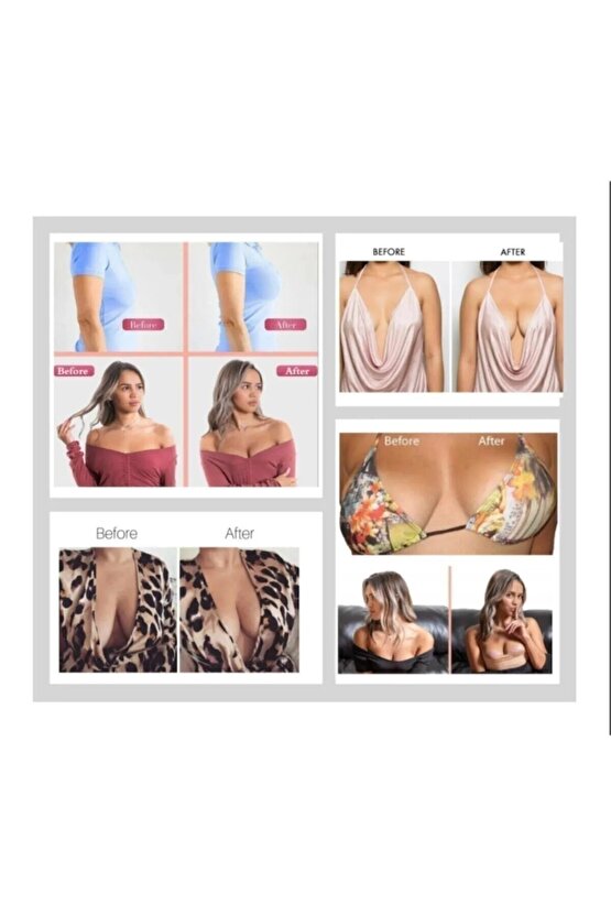 Kınesıo Tape Ağrı Bandı 5cm X 5 Mtr -mavi Renk