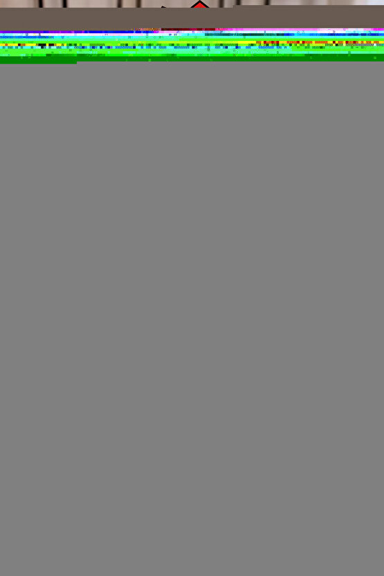 Nc17-3925476-abl1 Kol Saati