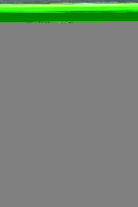 Aventurin Doğal Taş Bileklik 8mm