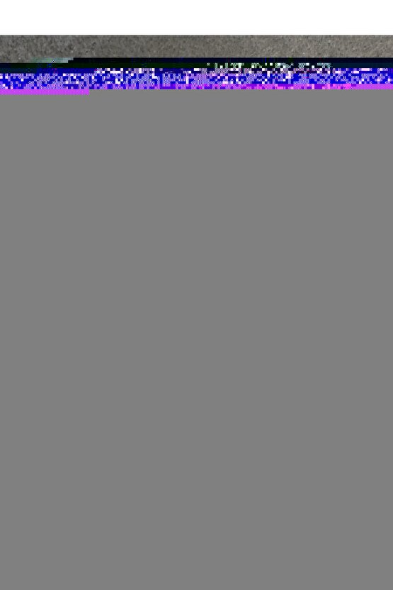 Pall Oksijen Konsantratörü Filtresi Okf-010