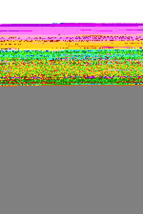 2 Adet Duvar Tipi Mop ve Süpürge Askılığı – Kaymaz Tutucu Aparat