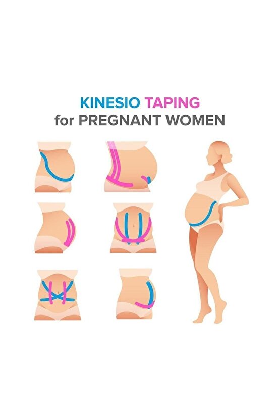 Ağrı Bantları Kinezyo Bandı 5cmx5m