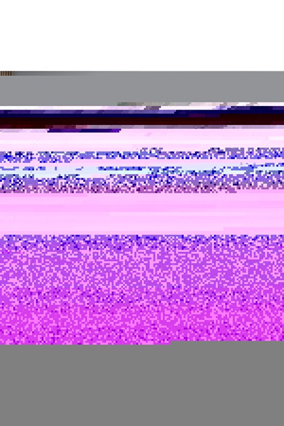 Yırtmaçlı Mini Şort Etek