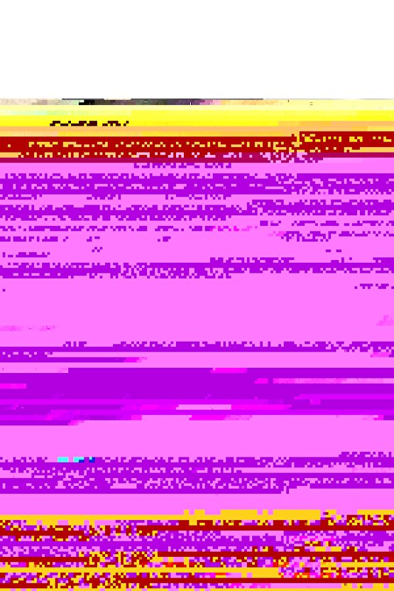 El Bilek Ateli Karpal Tünel Sendromu SOL EL MEDİUM