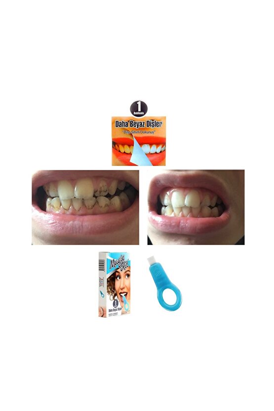 Diş Leke Silgisi 1 Aparatlı + 5 Yedek Süngerli Set X 2 Adet