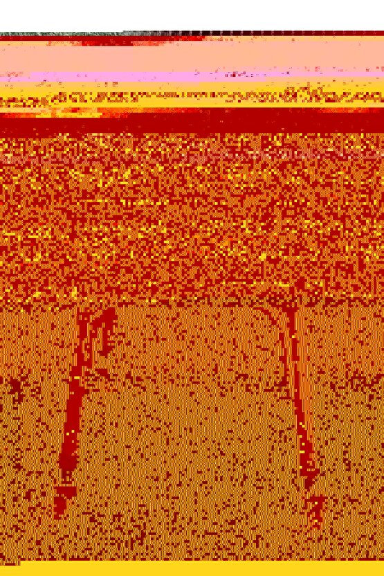 Hasta Yürüteci Çocuk Walker Tekerlekli Wolker Çocuk