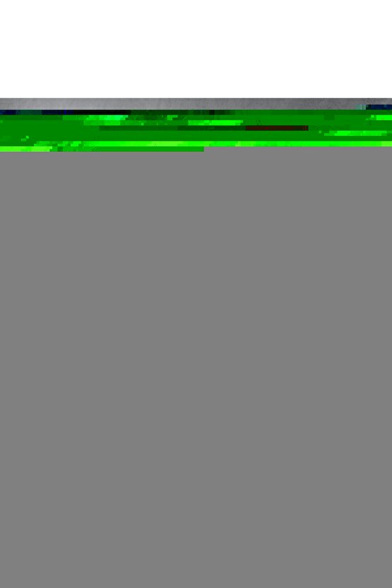 El Egzersiz Masaj Ve Duyu Topu, Yumuşak Dikenli Top Sarı Renk 8 Cm