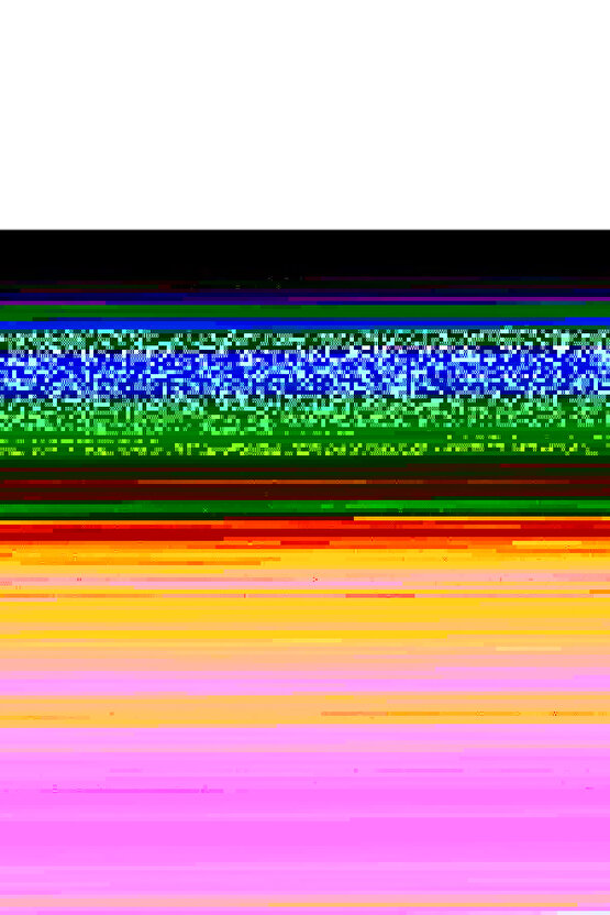 W607Tendon Destekli Ayak Bileklik  Topukluk Siyah Standart Beden