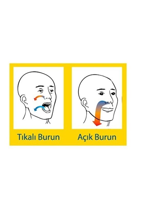 Horlama Önleyici Rahat Nefes Burun Aparatı-büyük 2 Adet