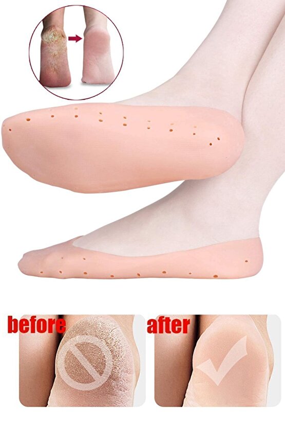 Main Shop Patik Ayak Topuk Çatlak Çorabı Ten Rengi Çorap Topuk Çatlak Giderici Ayak Bakım M-032