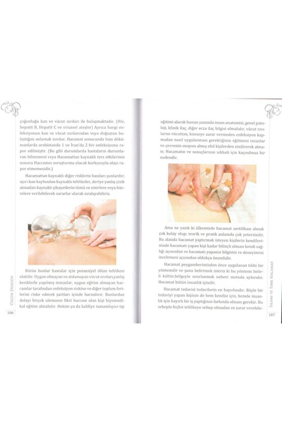 Hacamat, Islami Ve Tıbbi Tedavi Yöntemleri, Özgür Düzgün, 15x21 Cm. Mercan