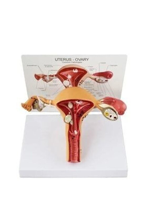 Uterus Pelvik TabanMaketi Model 41