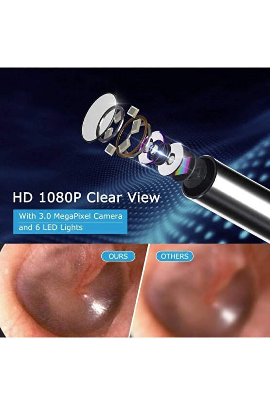 Kablosuz Hd Kameralı Kulak Temizleme Seti 360° açı 1296P Wifi Bağlantılı IOS ve Android Uyumlu