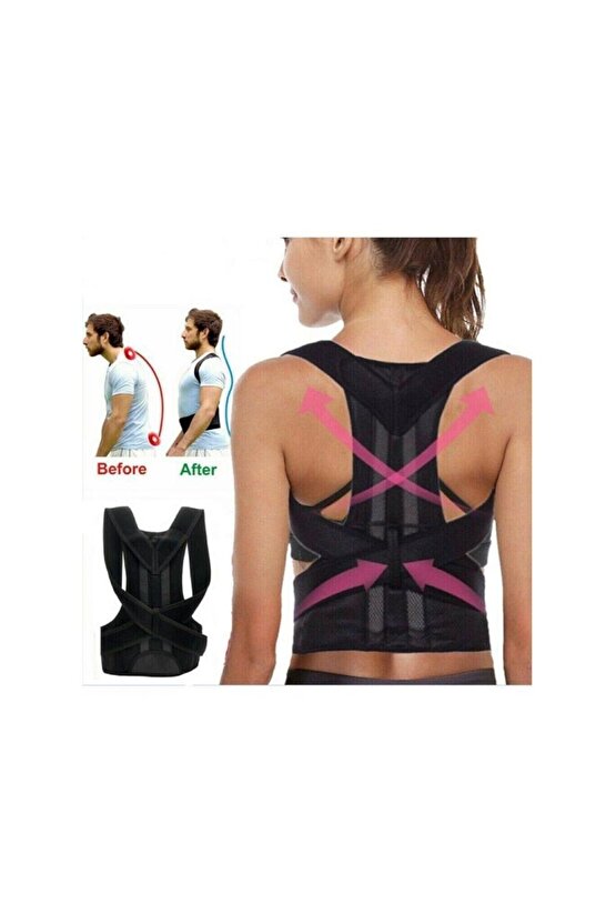 Dik Duruş Korsesi Kadın Erkek Ortopedik