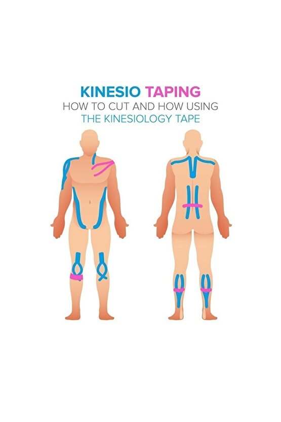 Ağrı Bantları Kinezyo Bandı 5cmx5m