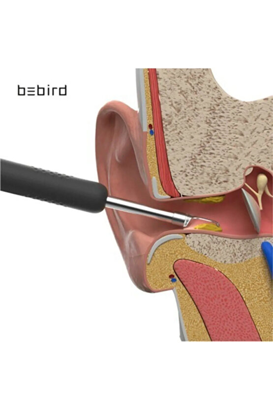 Kablosuz Hd Kameralı Kulak Temizleme Seti 360° açı 1296P Wifi Bağlantılı IOS ve Android Uyumlu