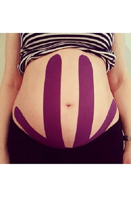 KARIN Toparlayıcı Band Bel Göbek Destek Bandı 2,5cm X 5m Kinosio Tape