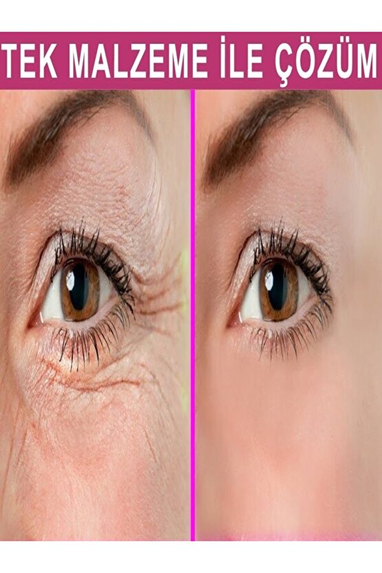 Göz - Göz Altı-Koltuk Altı -diz-dirsek Ve Bikini Bölgesi Beyazlatici 45 ml