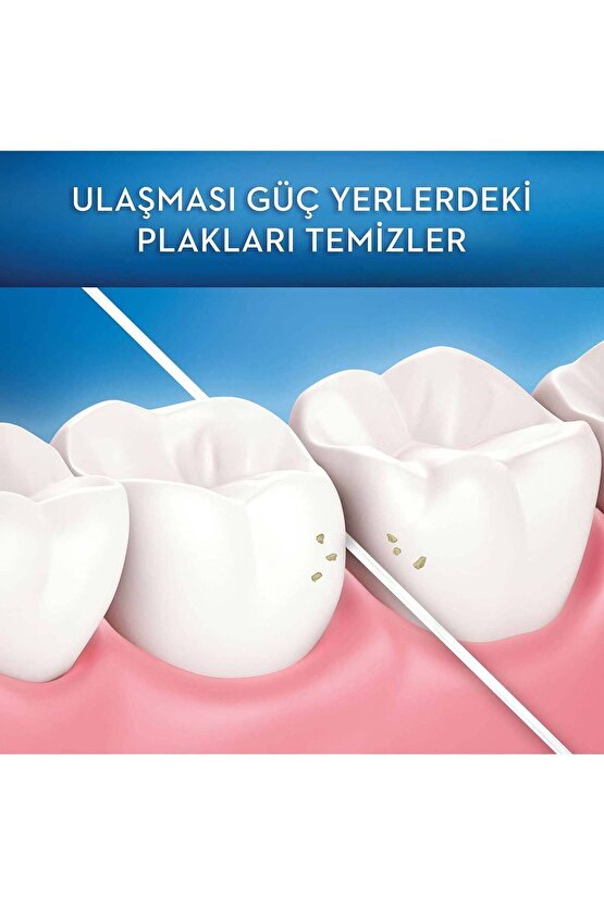 Diş Ipi Pro-expert Clinic Line 25 M