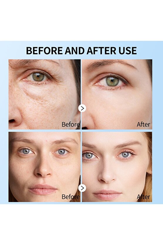 5’li HYALURONIC ACID YÜZ MASKESİ