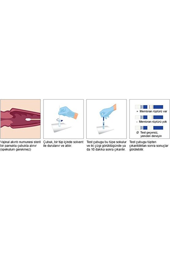 AmniSure Fetal Membran Yırtığı Testi